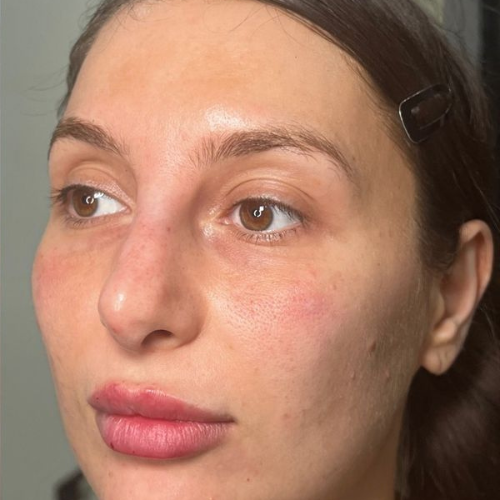 No more concealer mornings.