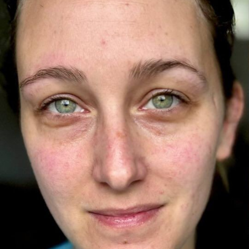 Younger skin