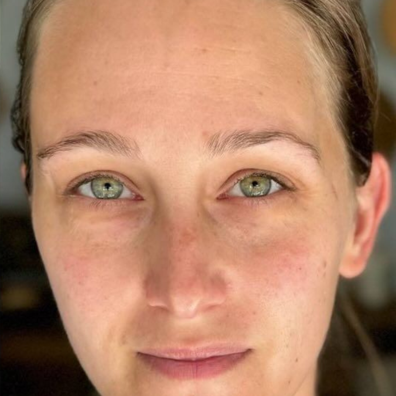 Younger skin
